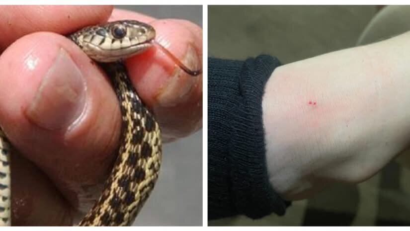 ბავშვს მინდორში თამაშის დროს გველის წიწილმა უკბინა – როგორია მისი მდგომარეობა