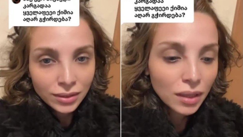 VIDEO: „მეტასტაზები სხვა ორგანოებზე არ მაქვს. ჩემი სიმსივნე ლოკალურია“ – რა აჩვენა თურქეთში ჩატარებულმა გამოკვლევებმა